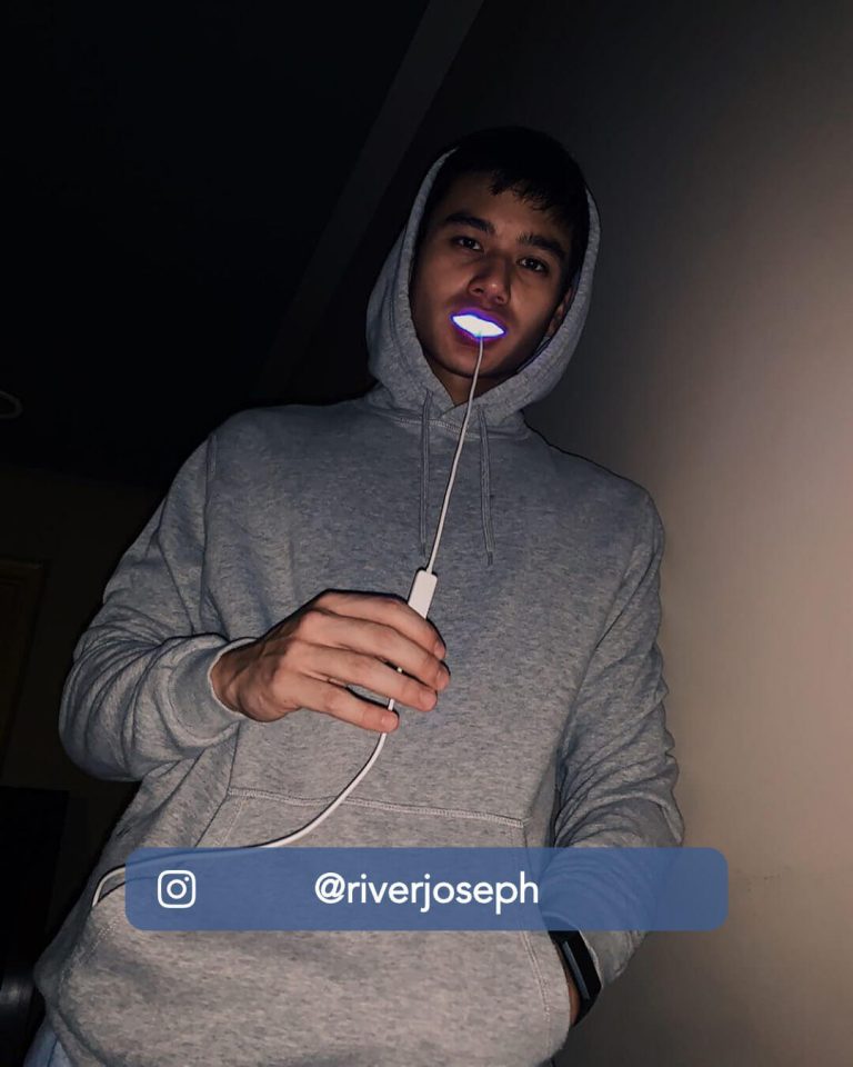 Teeth Whitening Kit Singapore