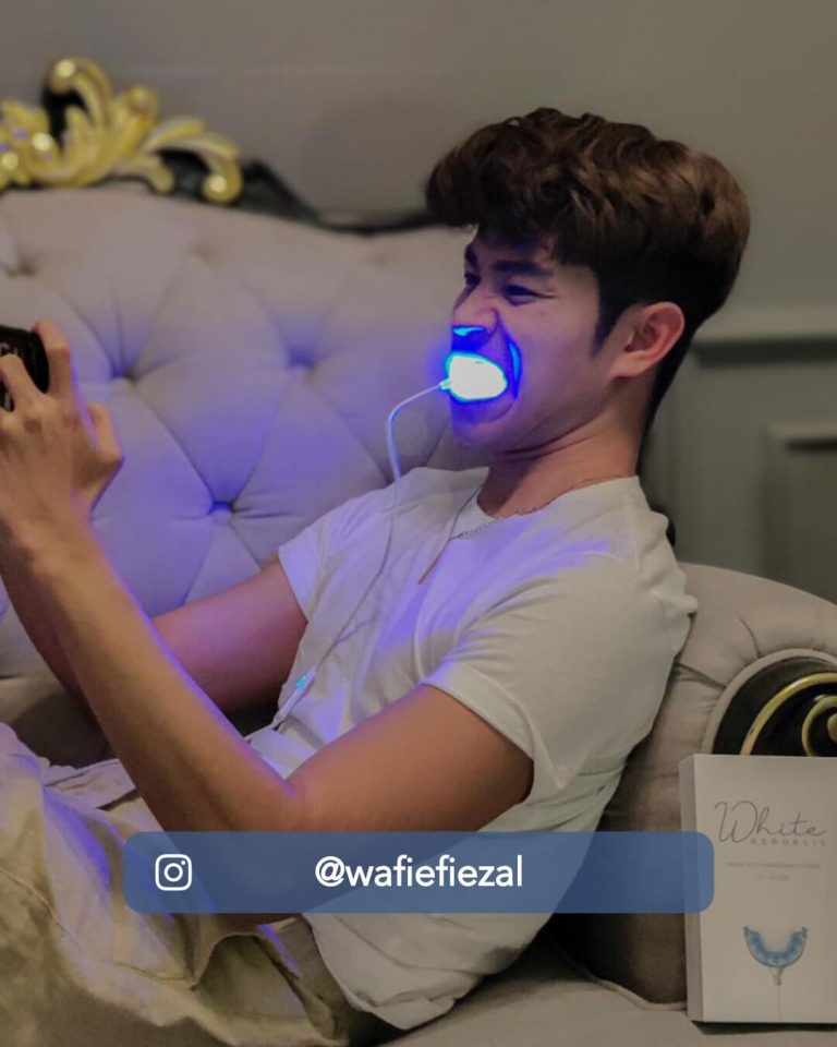 Best teeth whitening kit Singapore