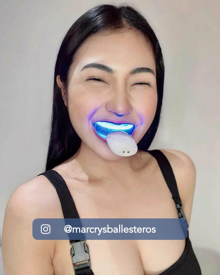 White Republic Wireless Teeth Whitening