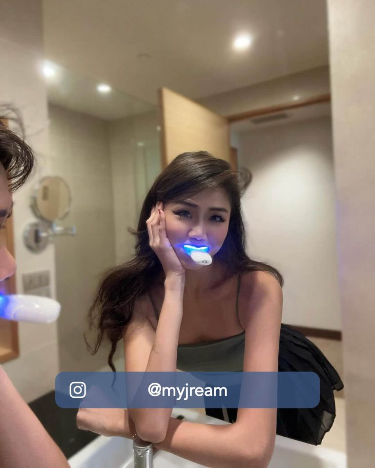 Teeth Whitening Singapore