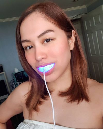 The Original Teeth Whitening Kit photo review