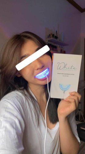The Original Teeth Whitening Kit photo review
