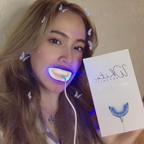 The Original Teeth Whitening Kit photo review