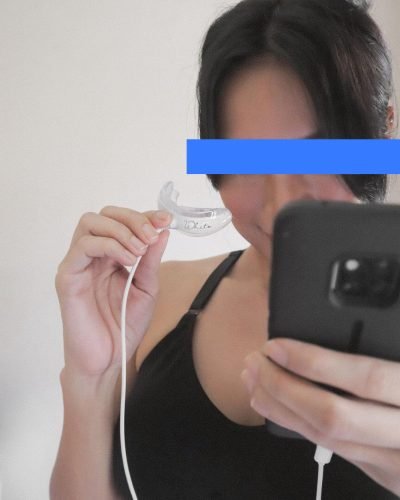 The Original Teeth Whitening Kit photo review